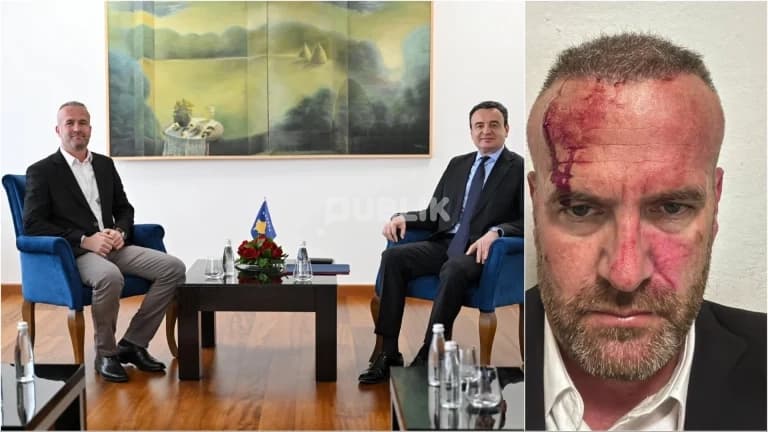 Dhunohet kreu i degës së Lëvizjes Vetëvendosje në Skënderaj